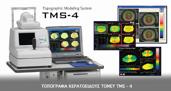 Topographic Modeling System - 4